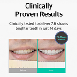 [LIVE ORALS] Puredia Teeth Whitening Kit - 14 days - SFOILER