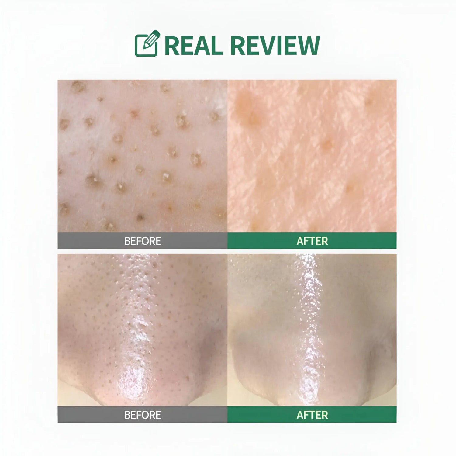 [SUNGBOON EDITOR] Green Tomato Pore Peeling Jumbo Pad  60pads / 120ml - SFOILER