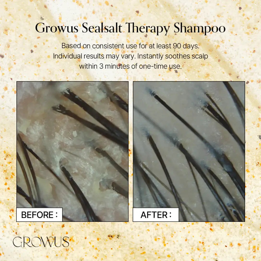 [GROWUS] Sea Salt Therapy Shampoo Special Set - SFOILER