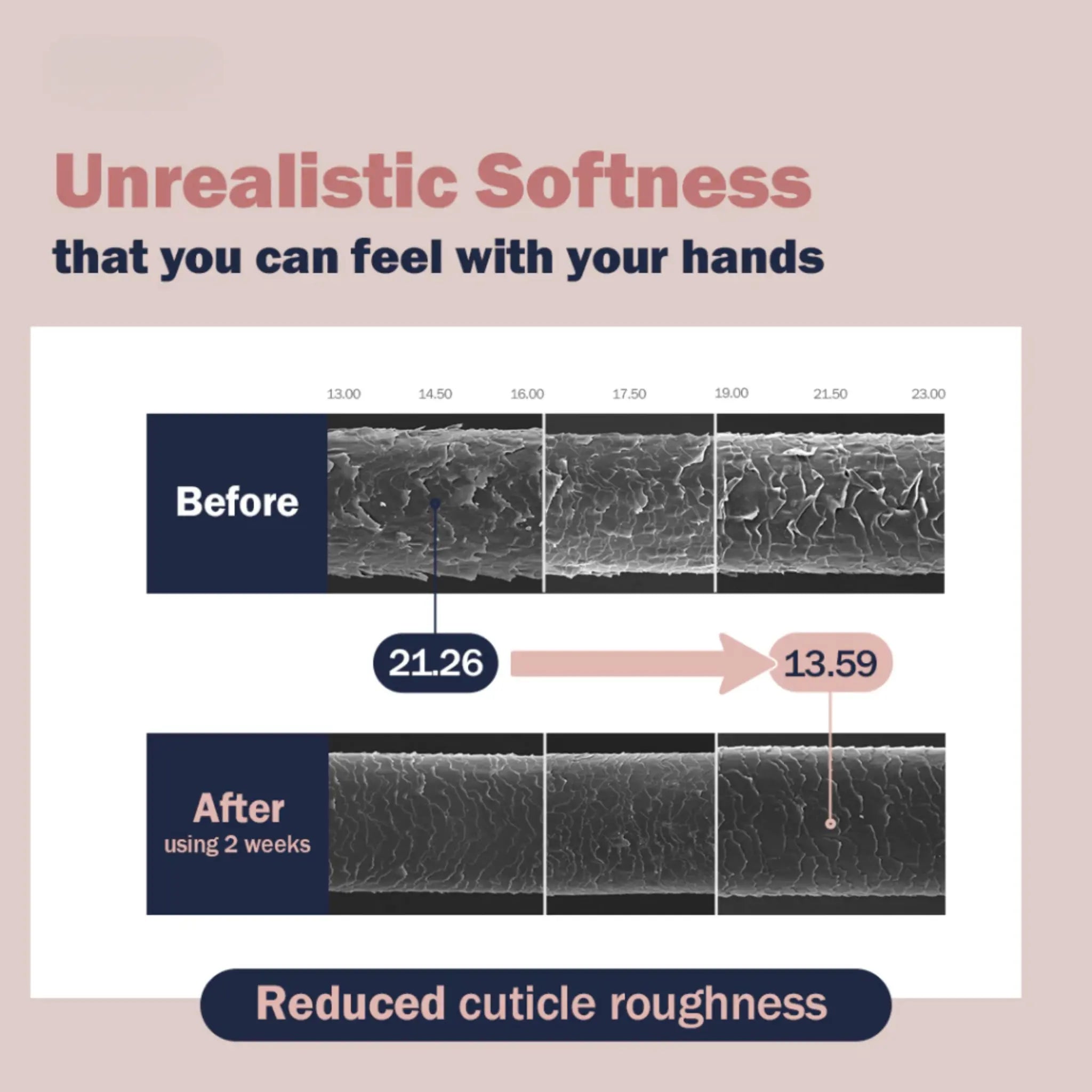 [UNOVE] Deep Damage Treatment EX Special Set - 207ml - SFOILER