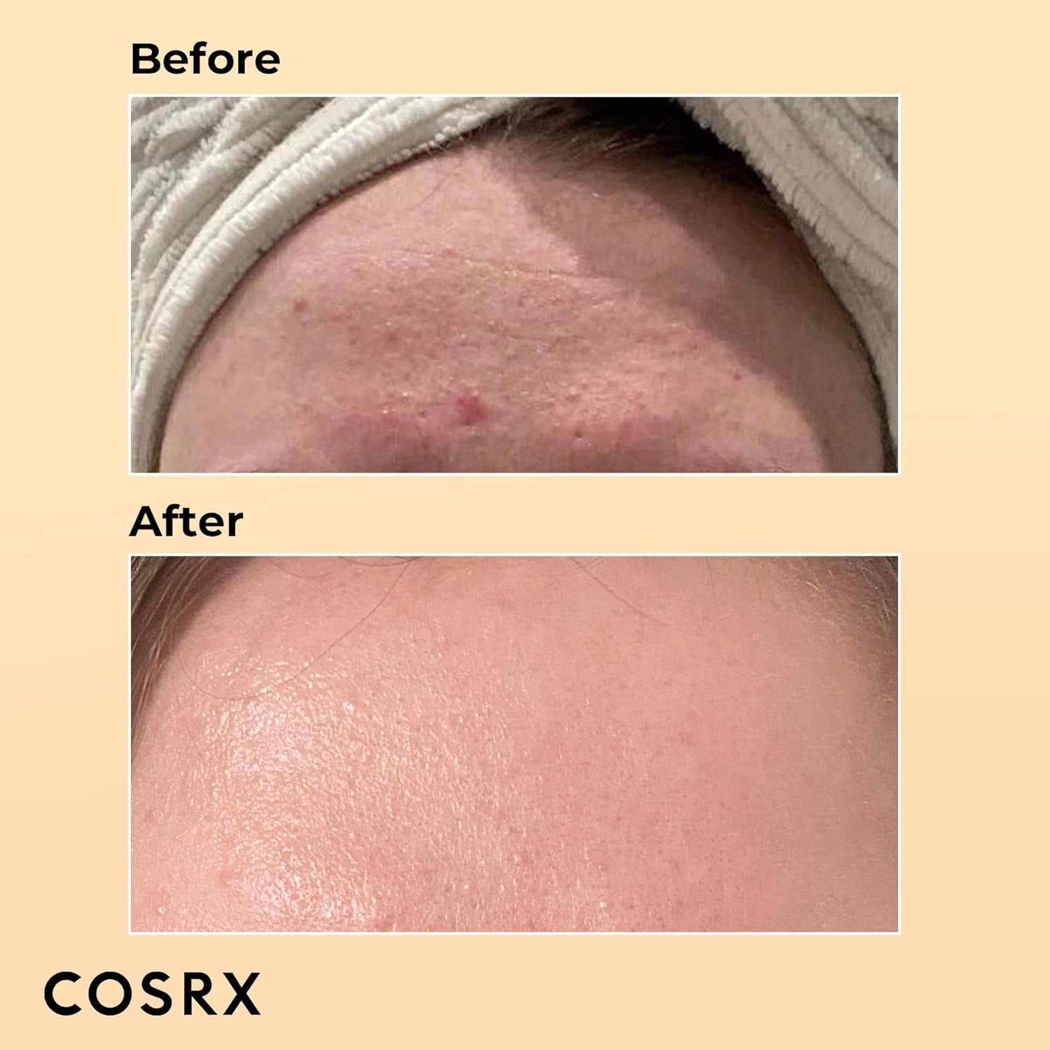 [COSRX] Advanced Snail 96 Mucin Power Essence - 100ml - SFOILER