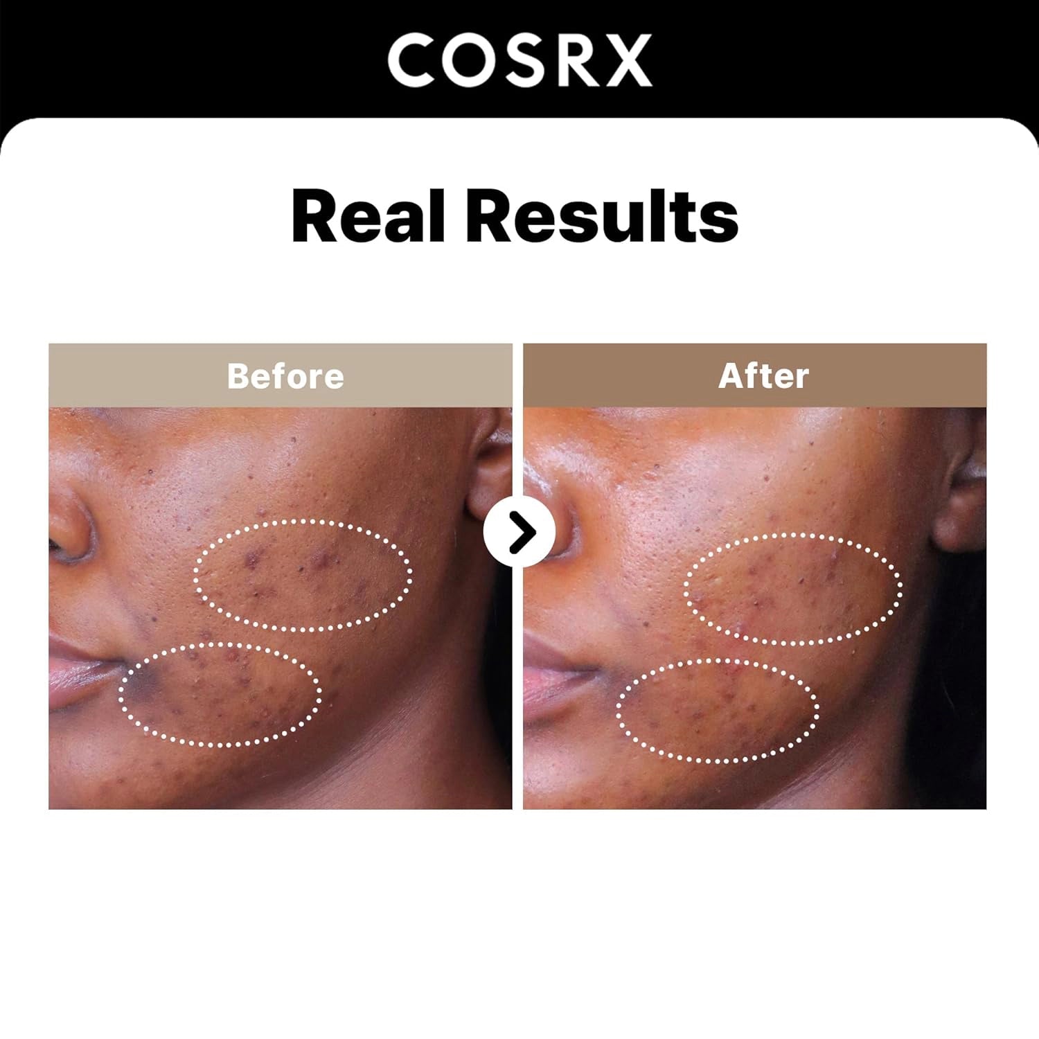 [COSRX] The Alpha Arbutin 2 Discoloration Care Serum Special Set - 50ml - SFOILER