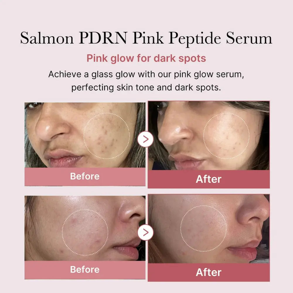 [MEDICUBE] PDRN Pink Peptide Serum - 30ml - SFOILER