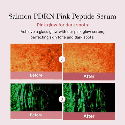 [MEDICUBE] PDRN Pink Peptide Serum - 30ml - SFOILER