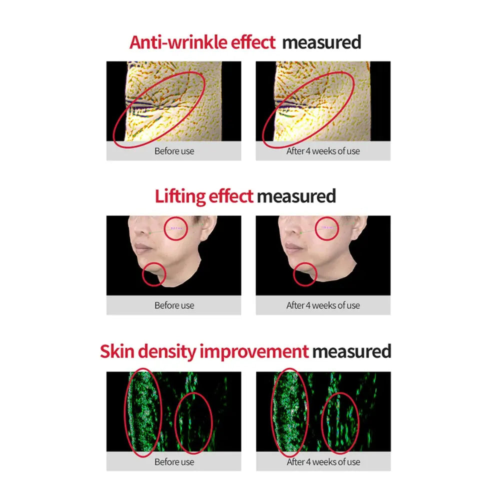 [Dr.Different] VITALIFT-A Forte Retinal 0.05% - 20g - SFOILER