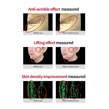 [Dr.Different] VITALIFT-A Forte Retinal 0.05% - 20g - SFOILER