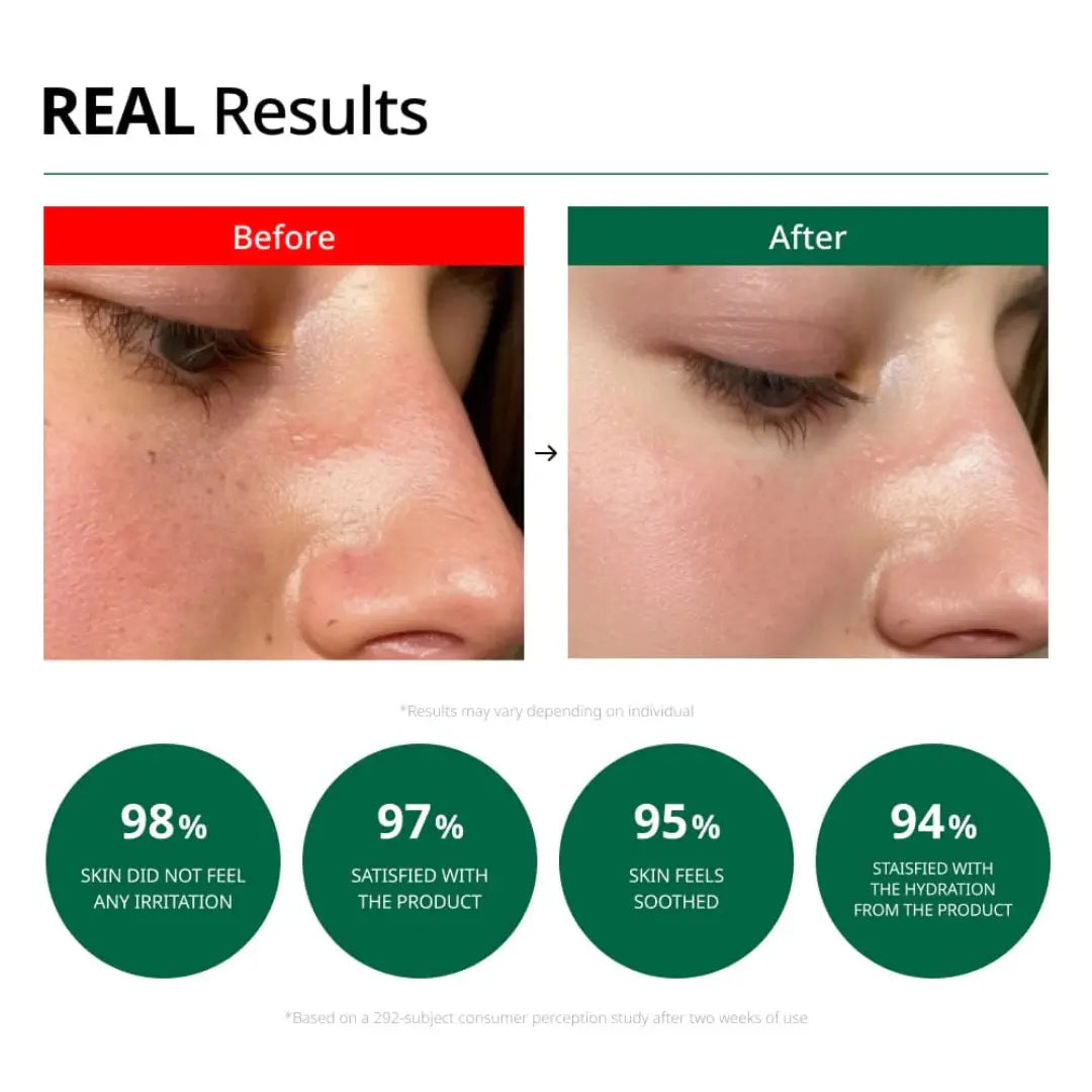 [Dr.G] Red Blemish Clear Soothing Cream Holiday Edition - SFOILER